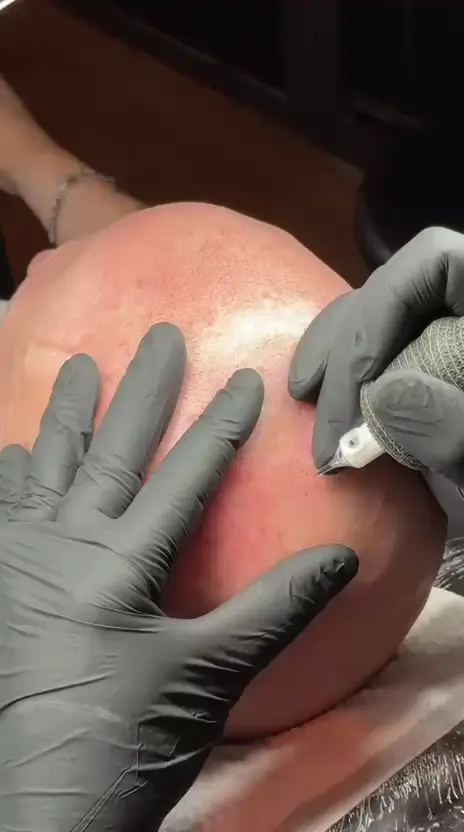 Fali Galán realizando micropigmentación capilar